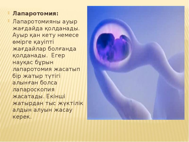 Лапаротомия:
Лапаротомия:
Лапаротомияны ауыр жағдайда қолданады. Ауыр қан кету немесе өмірге Лапаротомия:
Лапаротомия:
Лапаротомияны ауыр жағдайда қолданады. Ауыр қан кету немесе өмірге