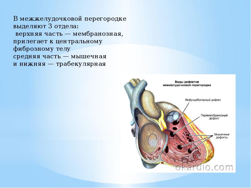 Тетрада фалло презентация