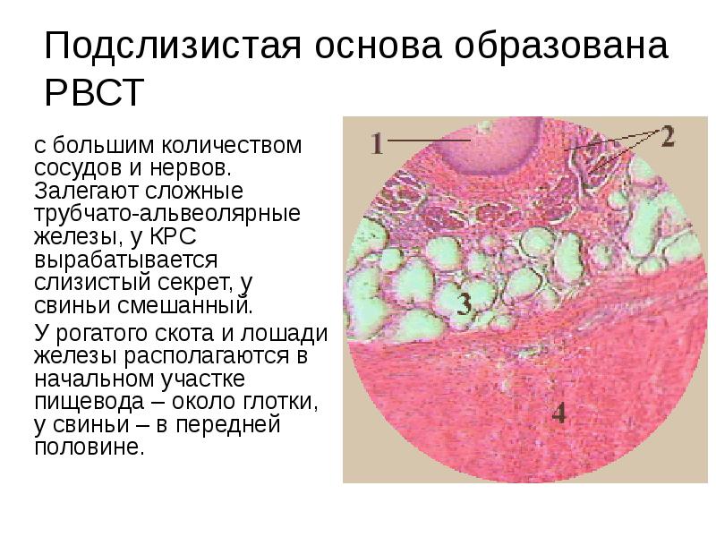 Подслизистое образование желудка патанатомия. Образование пилорического отдела желудка. Подслизистое образование желудка. Эндоскопическая классификация для подслизистых образований желудка. Подслизистое образование желудка что это.