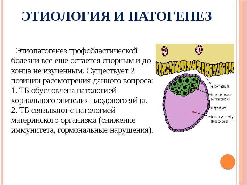 Трофобластическая болезнь презентация