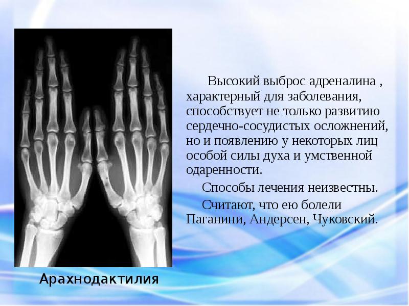 Выброс адреналина симптомы ощущения