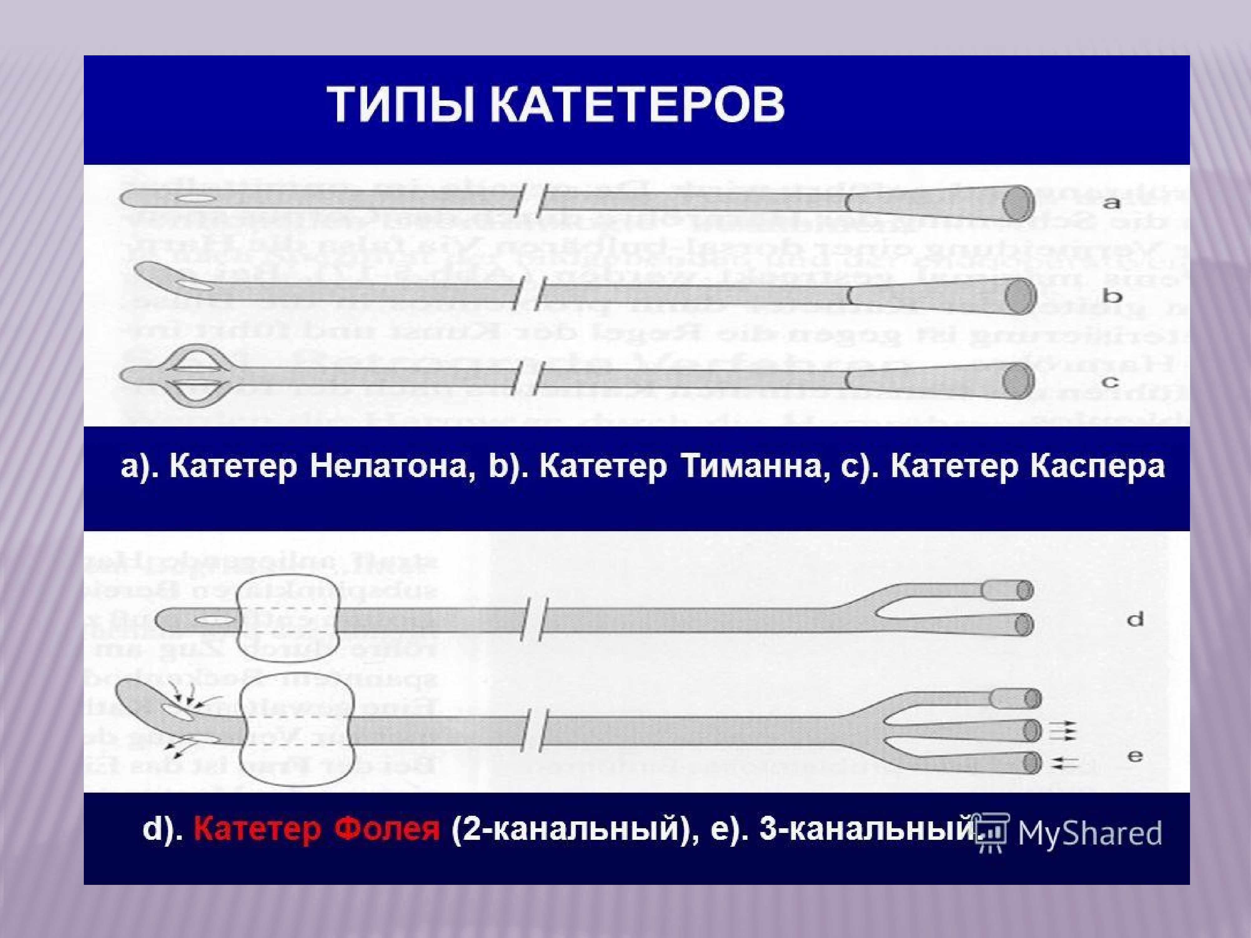 Виды уретральных катетеров презентация