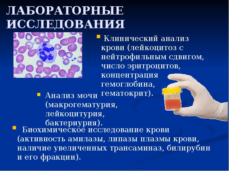 ЛАБОРАТОРНЫЕ ИССЛЕДОВАНИЯ
Анализ мочи (макрогематурия, лейкоцитурия, бактериурия). ЛАБОРАТОРНЫЕ ИССЛЕДОВАНИЯ
Анализ мочи (макрогематурия, лейкоцитурия, бактериурия).