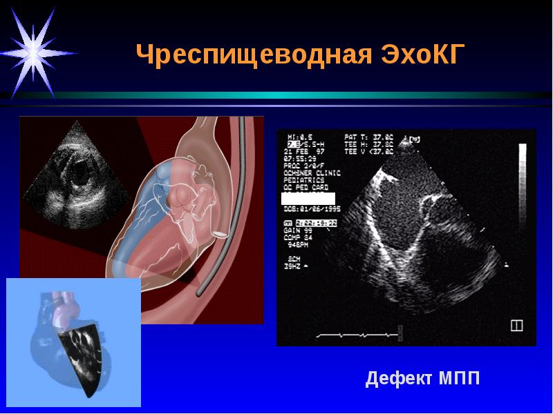 Лучевая диагностика сердечно сосудистой системы презентация