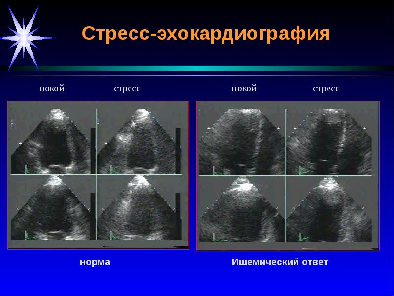 Лучевая диагностика сердечно сосудистой системы презентация