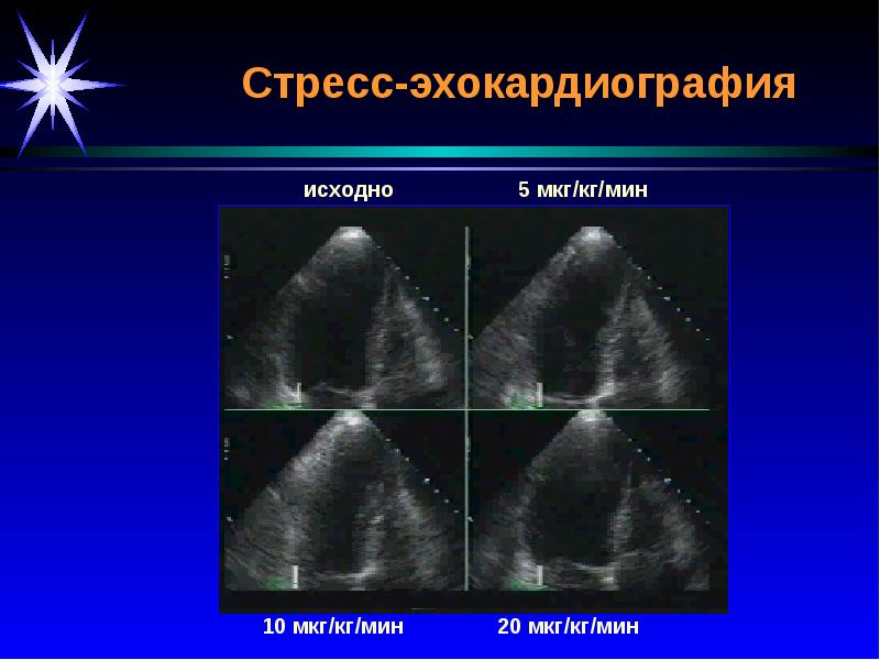 Лучевая диагностика сердечно сосудистой системы презентация