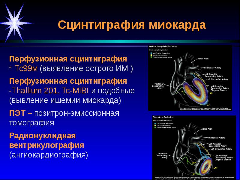 Лучевая диагностика сердечно сосудистой системы презентация