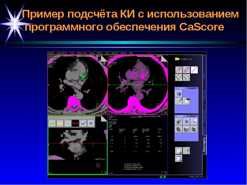 Лучевая диагностика сердечно сосудистой системы презентация