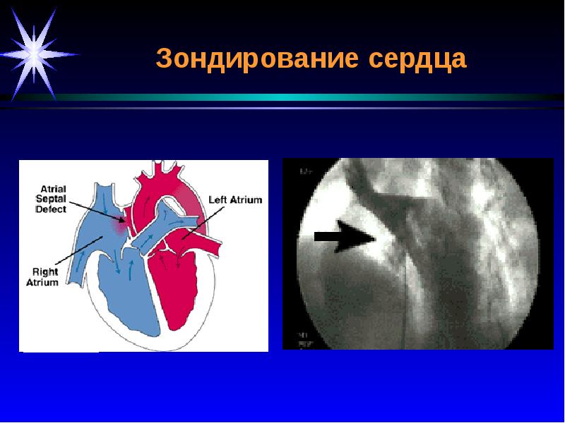 Лучевая диагностика сердечно сосудистой системы презентация