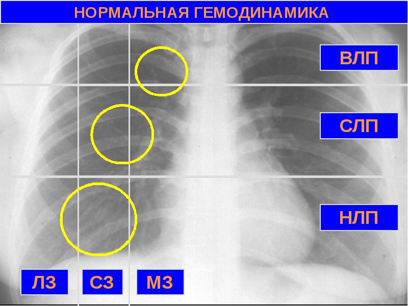 Лучевая диагностика сердечно сосудистой системы презентация