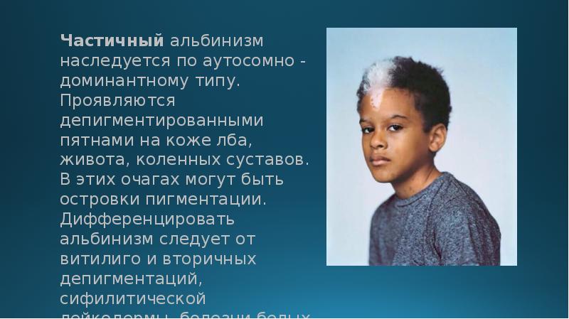 Частичный альбинизм наследуется по аутосомно - доминантному типу. Проявляются депигментированными пятнами Частичный альбинизм наследуется по аутосомно - доминантному типу. Проявляются депигментированными пятнами