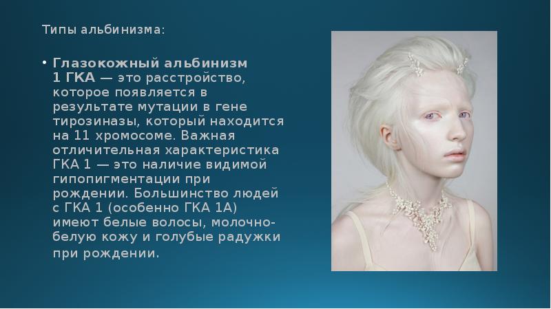 Альбинизмом страдают. Глазокожный альбинизм 1 ГКА. Глазокожный альбинизм 4 типа. Наследственная болезнь альбинизм. Наследственные заболевания альбинизм кратко.