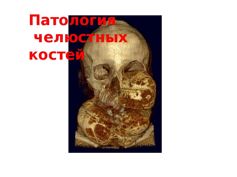 Патология челюстных костей Патология челюстных костей