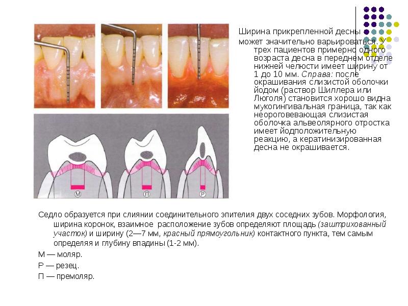 Особенности строения пародонта у детей презентация