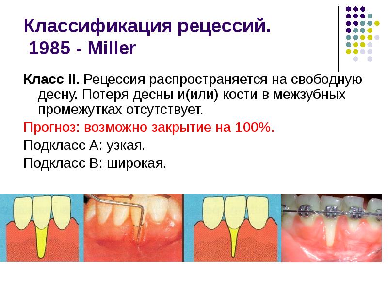 Общие принципы пародонтальной хирургии презентация