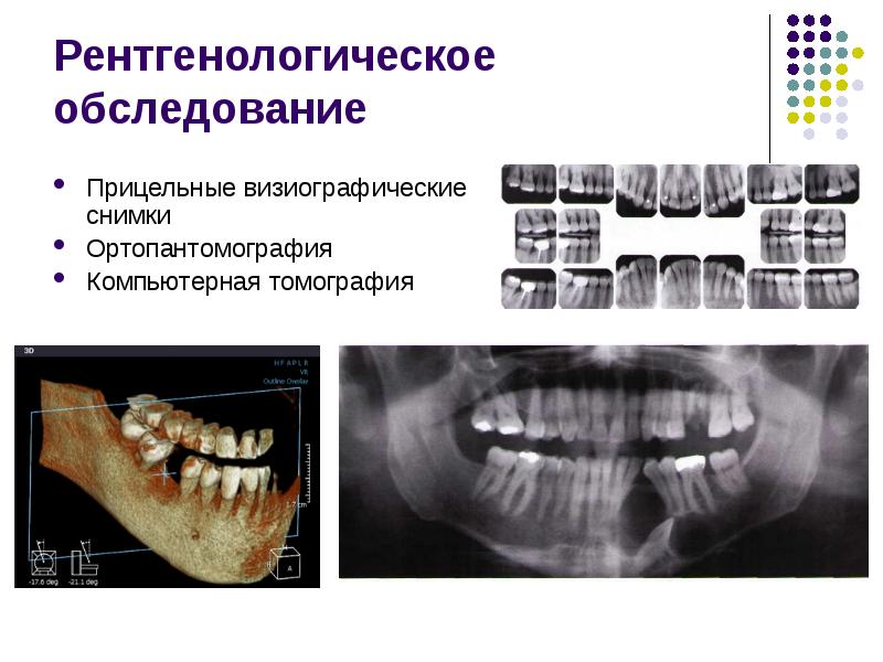 Рентгенодиагностика в стоматологии презентация