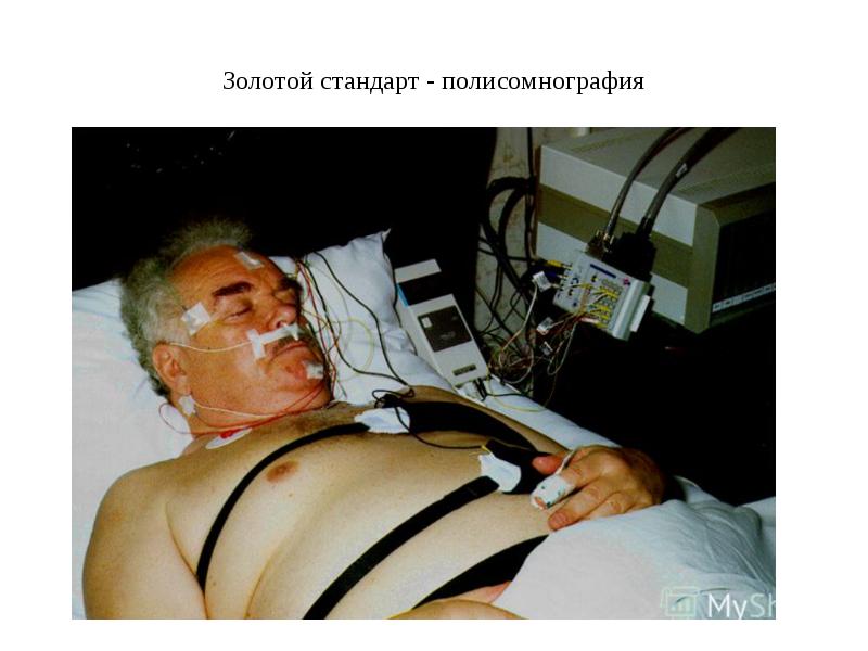Золотой стандарт - полисомнография Золотой стандарт - полисомнография