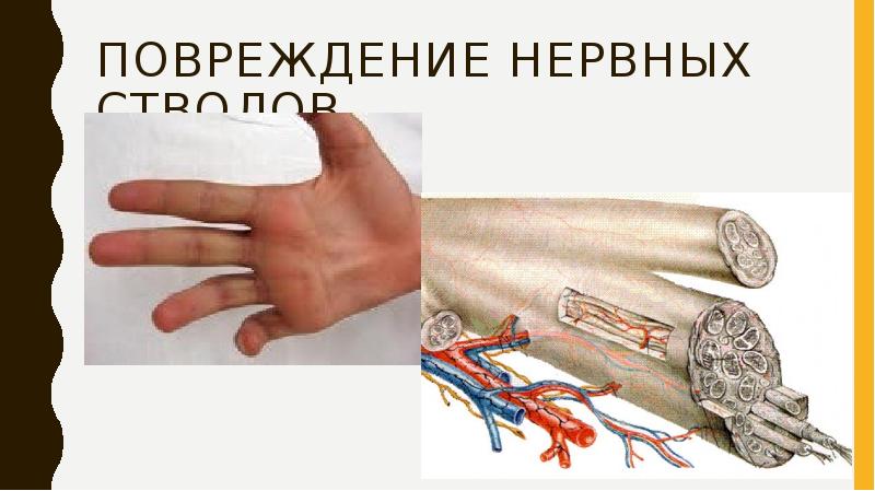 Повреждение нервных стволов фото. Механическое повреждение нервных стволов бывает при. Повреждение нервных стволов при инъекции.