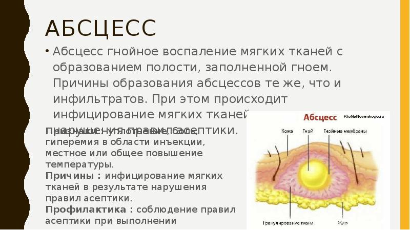 Постинъекционные осложнения реферат с картинками