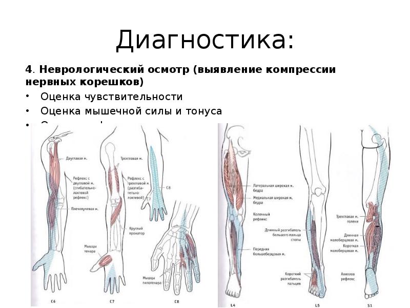 Дорсалгия поясничного отдела карта вызова