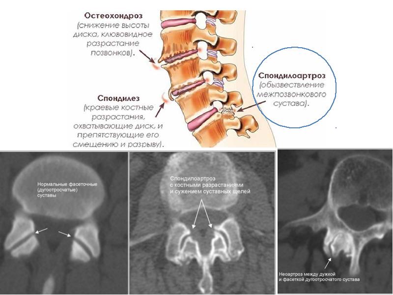 Дорсалгия грудного отдела позвоночника карта