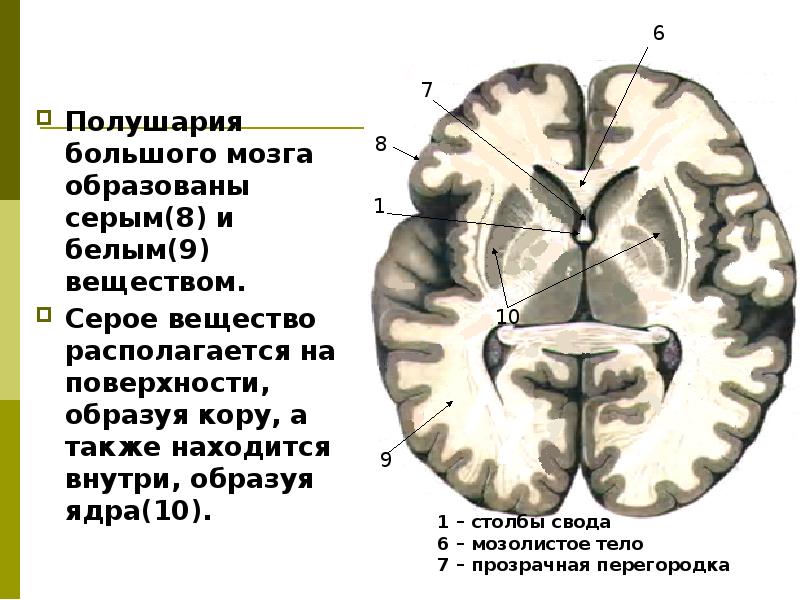 Белое вещество мозга фото