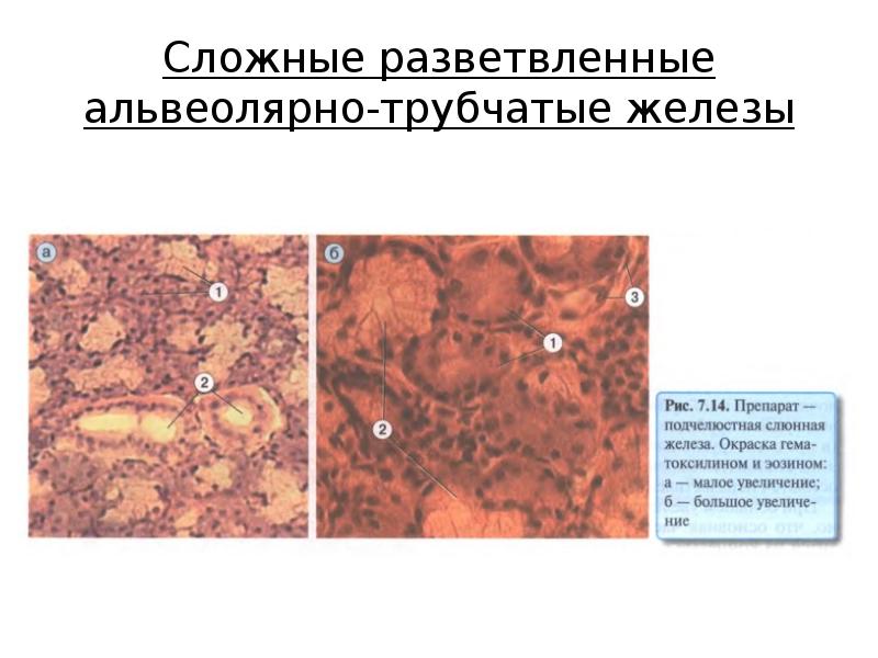 Трубчатая железа. Сложная альвеолярно-трубчатая железа препарат. Молочная железа сложная разветвленная альвеолярно-трубчатая железа. Альвеолярная трубчатая трубчатая железа. Простая разветвленная трубчатая железа гистология.