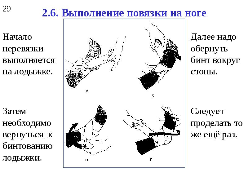 При наложении повязки на конечность следует. Повязка на голень алгоритм. При наложении повязки на конечность следует начать бинтование. Повязка на обмороженную конечность. При наложении повязки на конечности следует начать бинтовать.