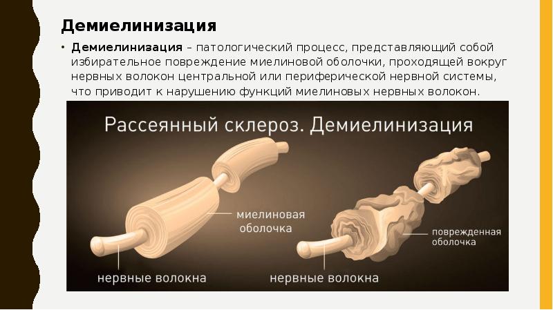 Демиелинизация
Демиелинизация
Демиелинизация – патологический процесс, представляющий собой избирательное повреждение миелиновой Демиелинизация
Демиелинизация
Демиелинизация – патологический процесс, представляющий собой избирательное повреждение миелиновой