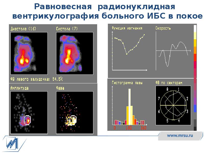 Радионуклидная диагностика презентация