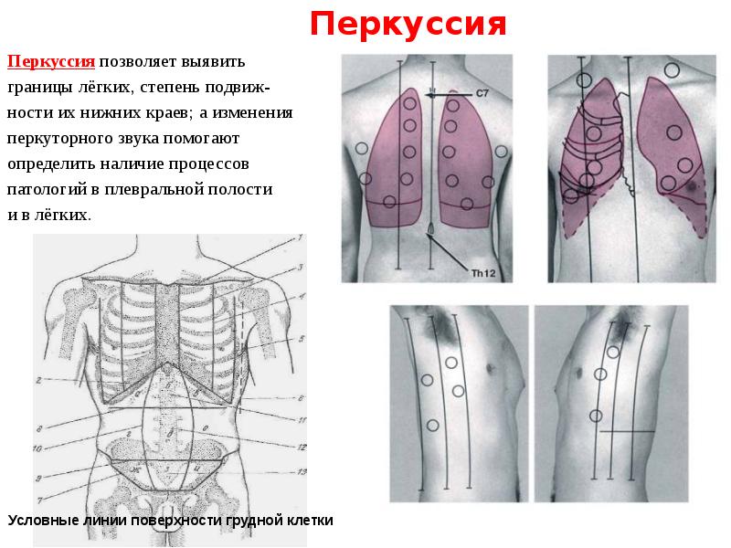 Схема сравнительной перкуссии легких