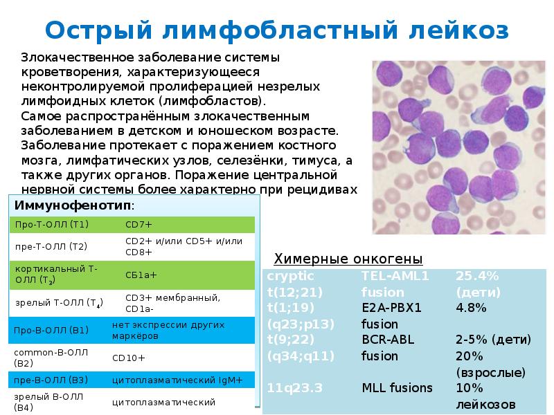 Лимфолейкоз анализ крови