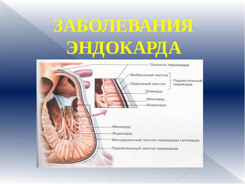 Может Ли Больной Эндокардитом Заниматься Сексом Может Ли Больной Эндокардитом Заниматься Сексом