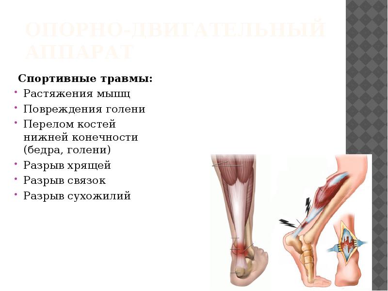 Рассмотрите рисунок с изображением травмы опорно двигательной системы назовите вид травмы