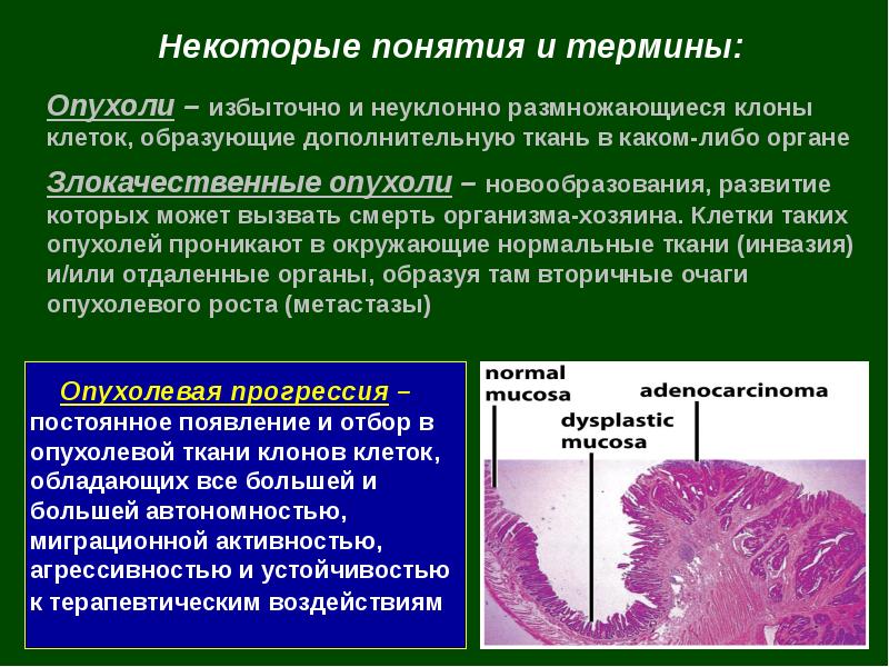 Определение понятия опухоль