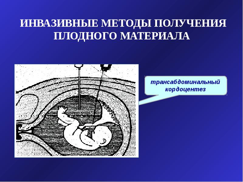 Инвазивные медицинские манипуляции