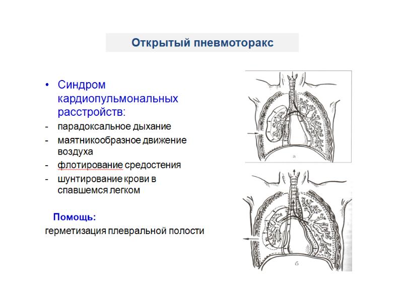 Физиология дыхания презентация анатомия