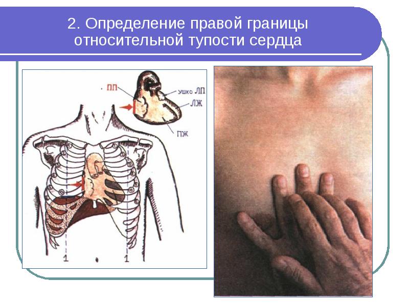 Пропедевтика органов дыхания презентация