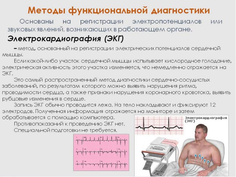 В каких условиях необходимо проводить исследование экг