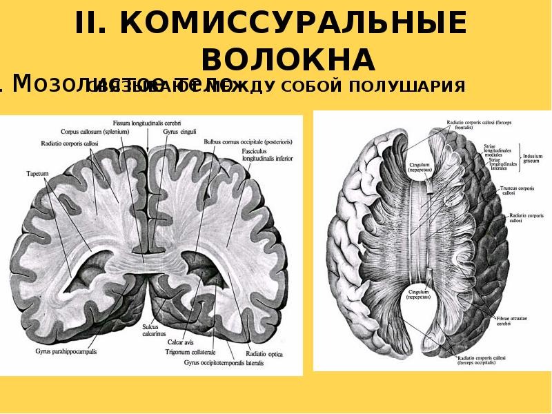 Конечный мозг презентация