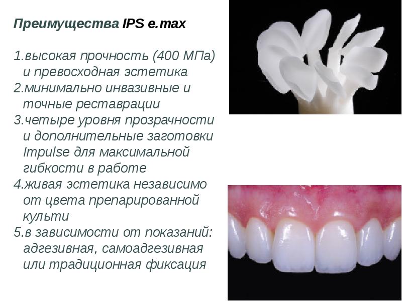 Презентация безметалловая керамика