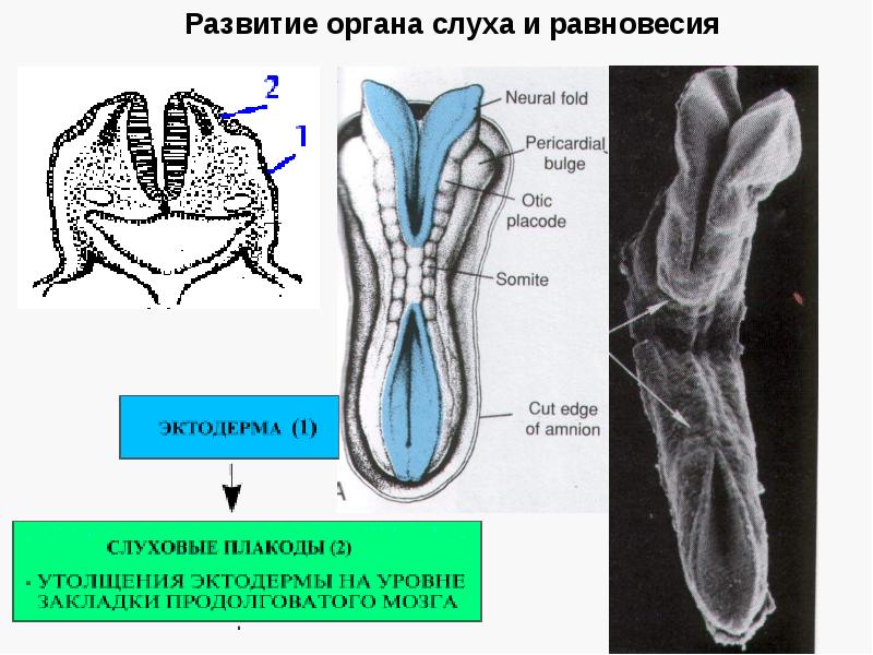 Гистофизиология органа слуха презентация