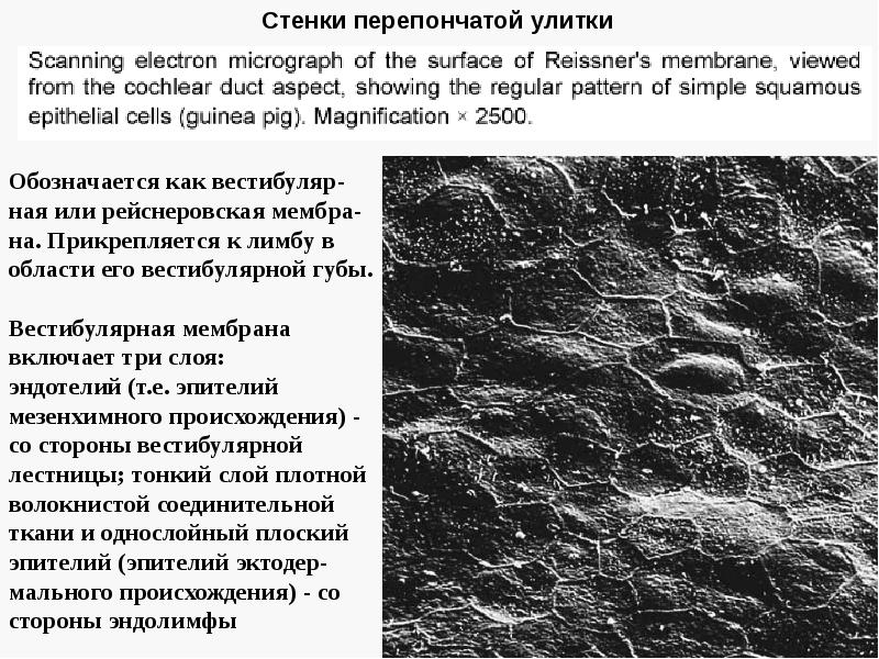 Гистофизиология органа слуха презентация