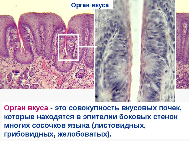 Орган слуха гистология презентация