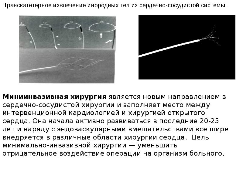 Методы исследования в ангиохирургии презентация