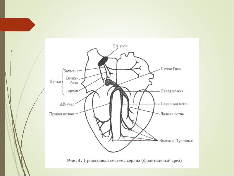 Блок схема аритмии сердца