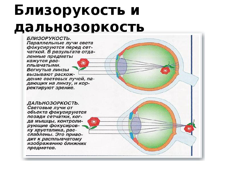 Презентация предупреждение близорукости и дальнозоркости