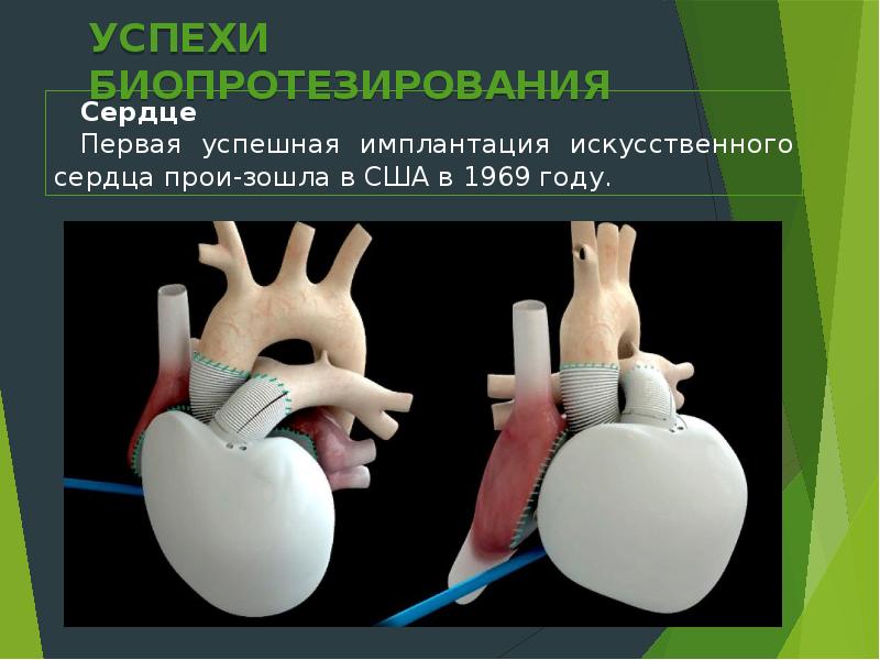 Протез презентация