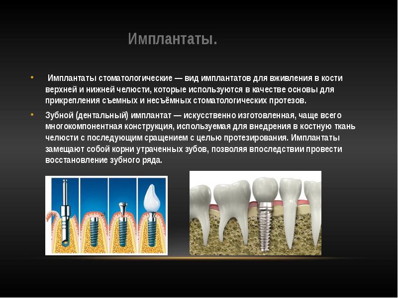 Остеоинтеграция имплантата презентация