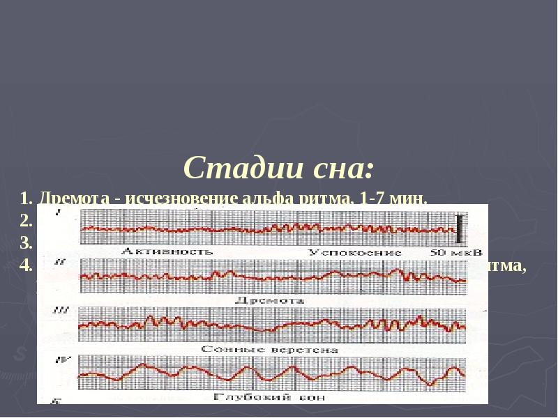 Стадии сна:
1. Дремота - исчезновение альфа ритма, 1-7 мин.
2. Стадии сна:
1. Дремота - исчезновение альфа ритма, 1-7 мин.
2.
